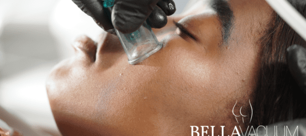 Vacuum Face Lift Facial Cupping treatment