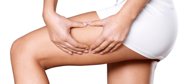 cupping for cellulite